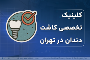 کلینیک تخصصی کاشت دندان در تهران