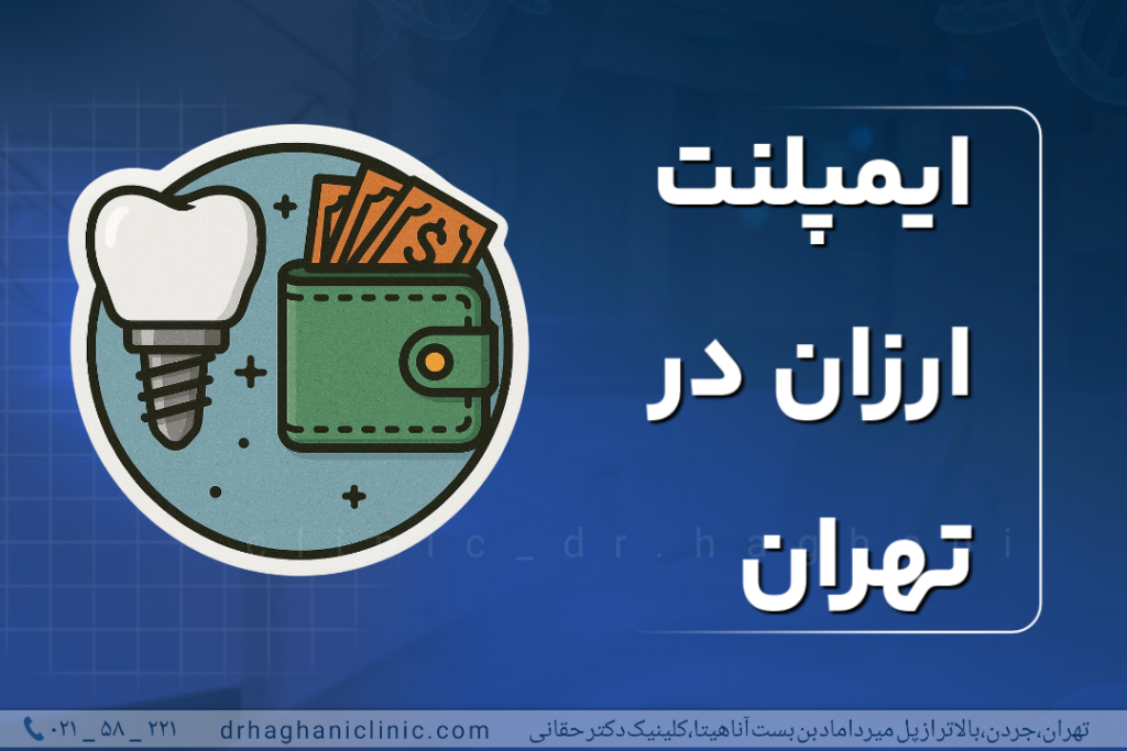 ایمپلنت ارزان در تهران