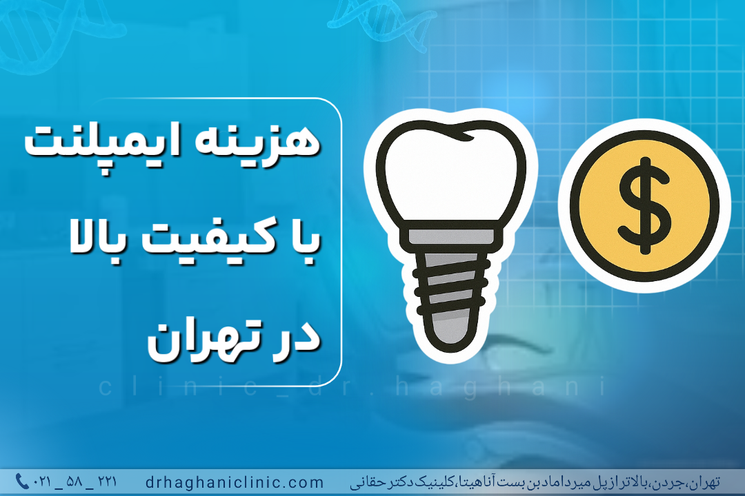 هزینه ایمپلنت با کیفیت بالا در تهران