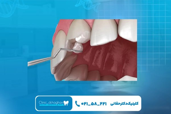 دندانپزشکی شمال تهران