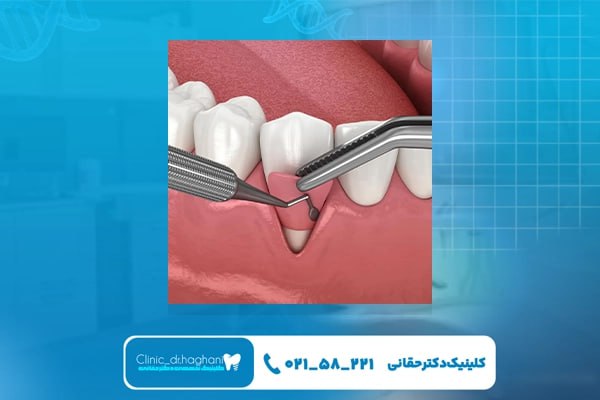 خدمات دندانپزشکی مدرن در کلینیک دندانپزشکی دکتر حقانی