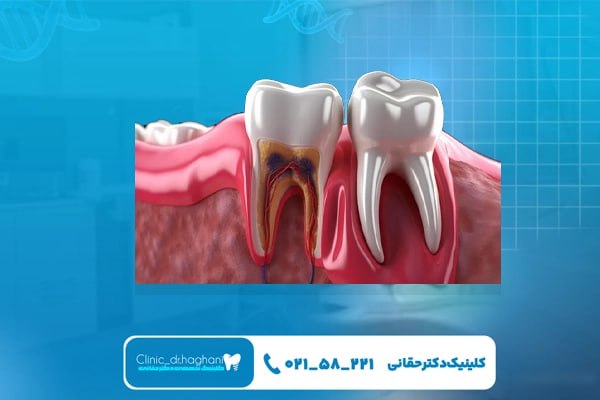 خدمات دندانپزشکی حرفه‌ای در کلینیک دندانپزشکی دکتر حقانی