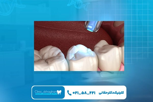بهترین مرکز دندانپزشکی در جردن
