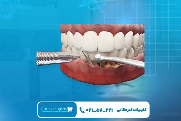 دندانپزشکی حرفهای دندانپزشکی حرفهای