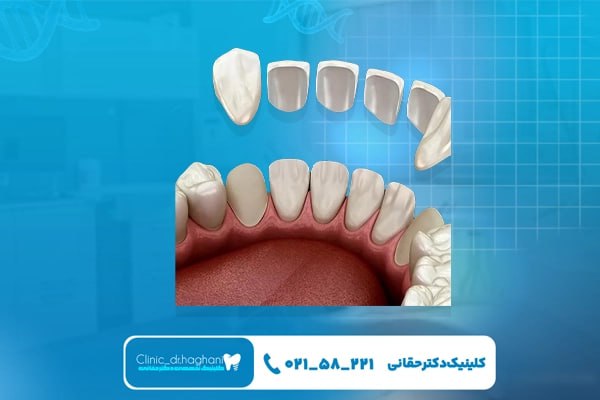 دندانپزشکی حرفه‌ ای