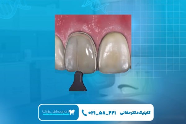 دندانپزشکی حرفه‌ ای تهران