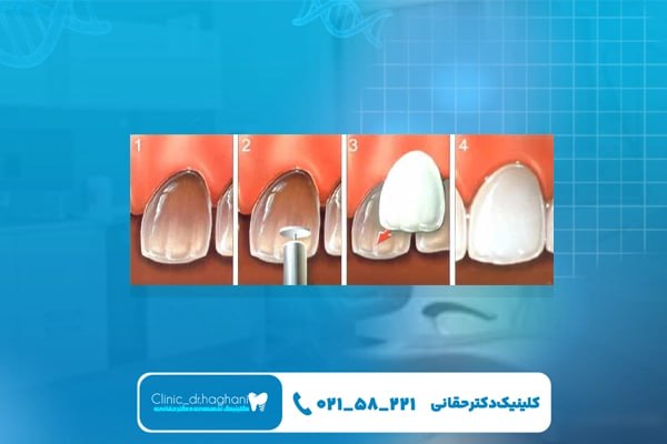 دندانپزشکی حرفه‌ ای تهران