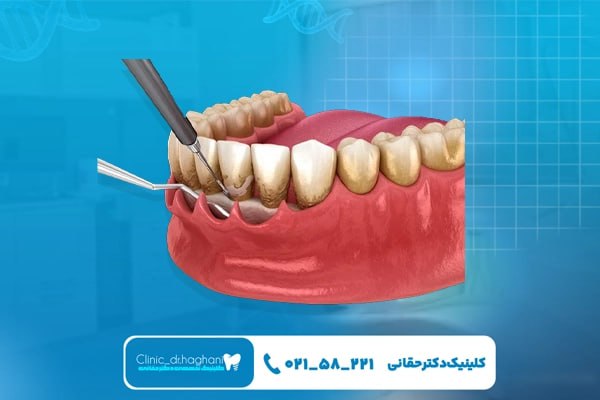 درمان‌های ترمیمی در دندانپزشکی
