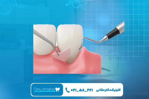 درمان‌های کم‌تهاجمی در کلینیک دندانپزشکی مدرن 