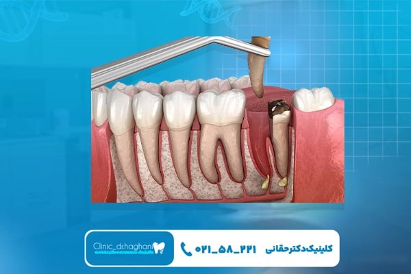 مشخصات دندانپزشکی مدرن