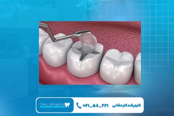 خدمات دندانپزشکی ترمیمی