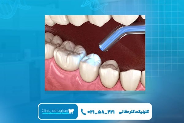 بهترین دندانپزشک چه ویژگی هایی دارد؟