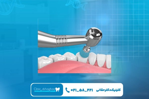مزایای دندانپزشکی حرفهای در کلینیک دکتر حقانی مزایای دندانپزشکی حرفهای در کلینیک دکتر حقانی