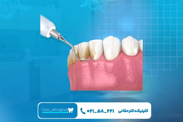 خدمات کامل دندانپزشکی شمال تهران در کلینیک دندانپزشکی دکتر حقانی