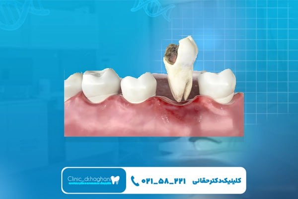 کلینیک دندانپزشکی در شمال تهران