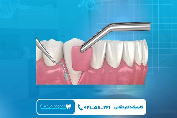 خدمات دندانپزشکی مدرن در کلینیک دندانپزشکی دکتر حقانیخدمات دندانپزشکی مدرن در کلینیک دندانپزشکی دکتر حقانی