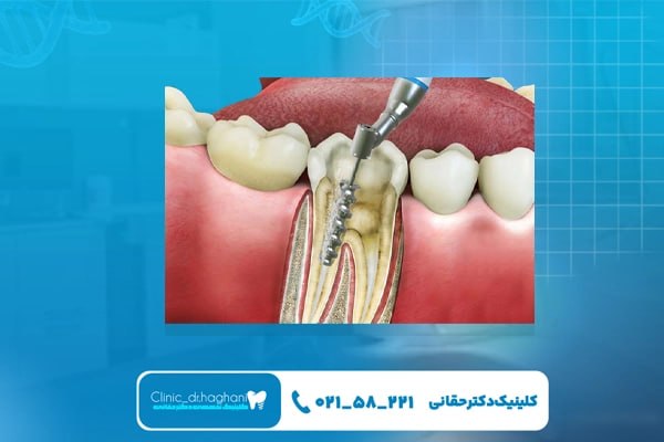 دندانپزشک حرفه ای در شمال تهران