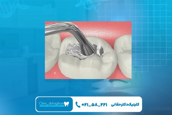 معرفی کلینیک دندانپزشکی دکتر حقانی به عنوان بهترین مرکز دندانپزشکی در جردن