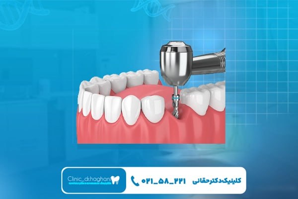 اهمیت تشخیص دقیق در دندانپزشکی حرفهای اهمیت تشخیص دقیق در دندانپزشکی حرفهای