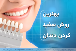 بهترین روش سفید کردن دندان ها