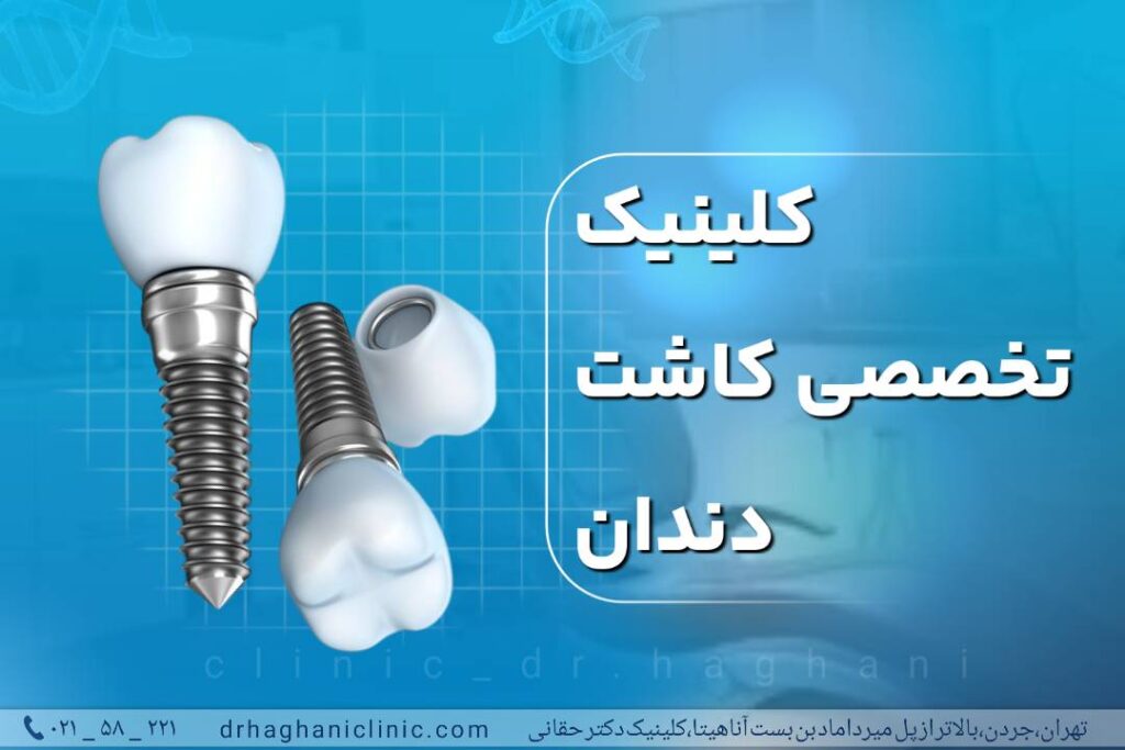 کلینیک تخصصی کاشت دندان