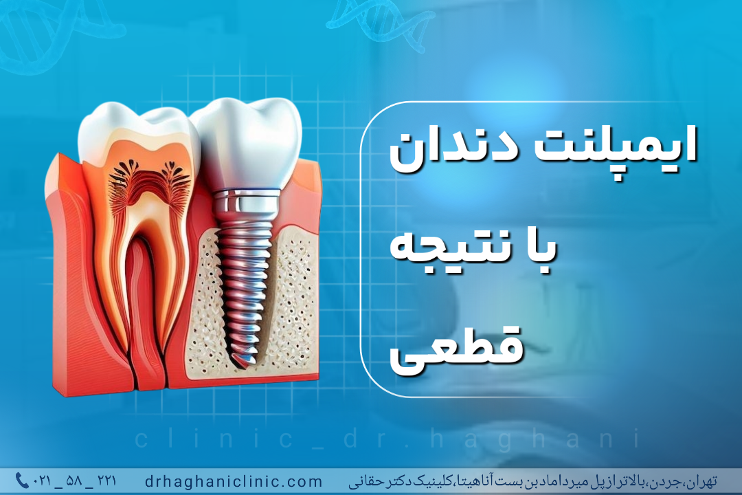 ایمپلنت دندان با نتیجه قطعی