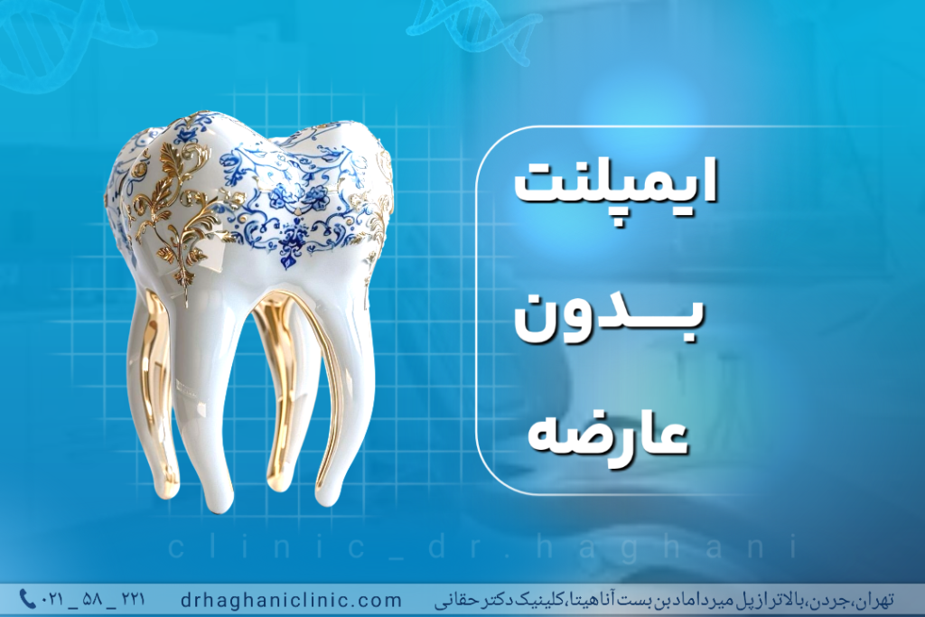 ایمپلنت دندان بدون عارضه