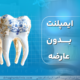 ایمپلنت دندان بدون عارضه