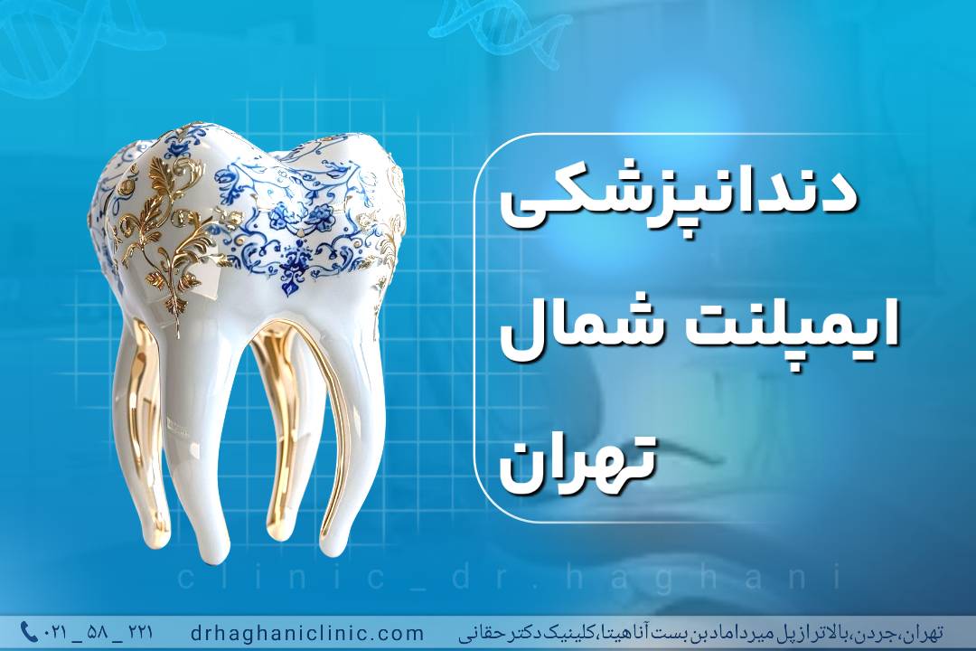بهترین دندانپزشکی ایمپلنت شمال تهران