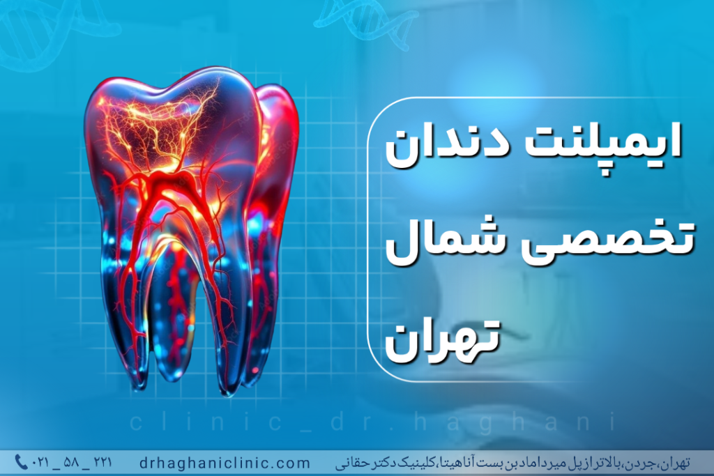 ایمپلنت دندان تخصصی شمال تهران
