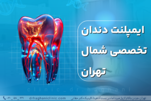 ایمپلنت دندان تخصصی شمال تهران