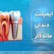 ایمپلنت دندان ماندگار