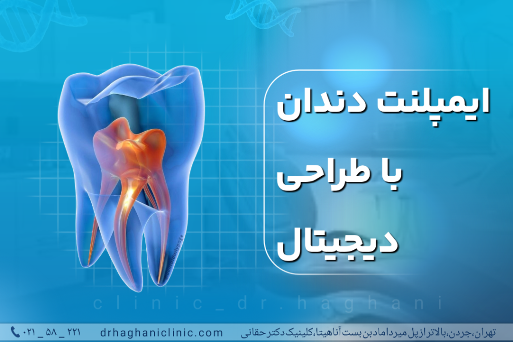ایمپلنت دندان با طراحی دیجیتال