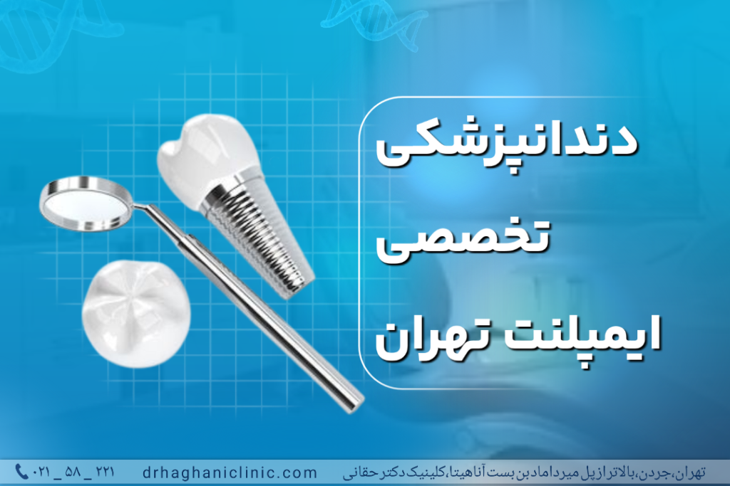 دندانپزشکی تخصصی ایمپلنت تهران