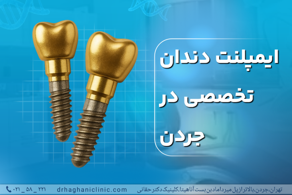 ایمپلنت دندان تخصصی در جردن