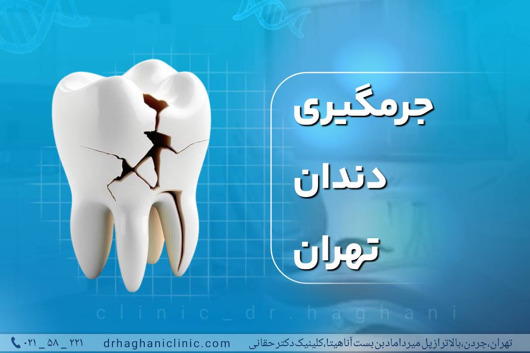 جرمگیری دندان تهران
