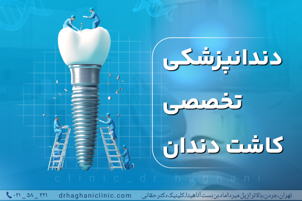 دندانپزشکی تخصصی کاشت دندان