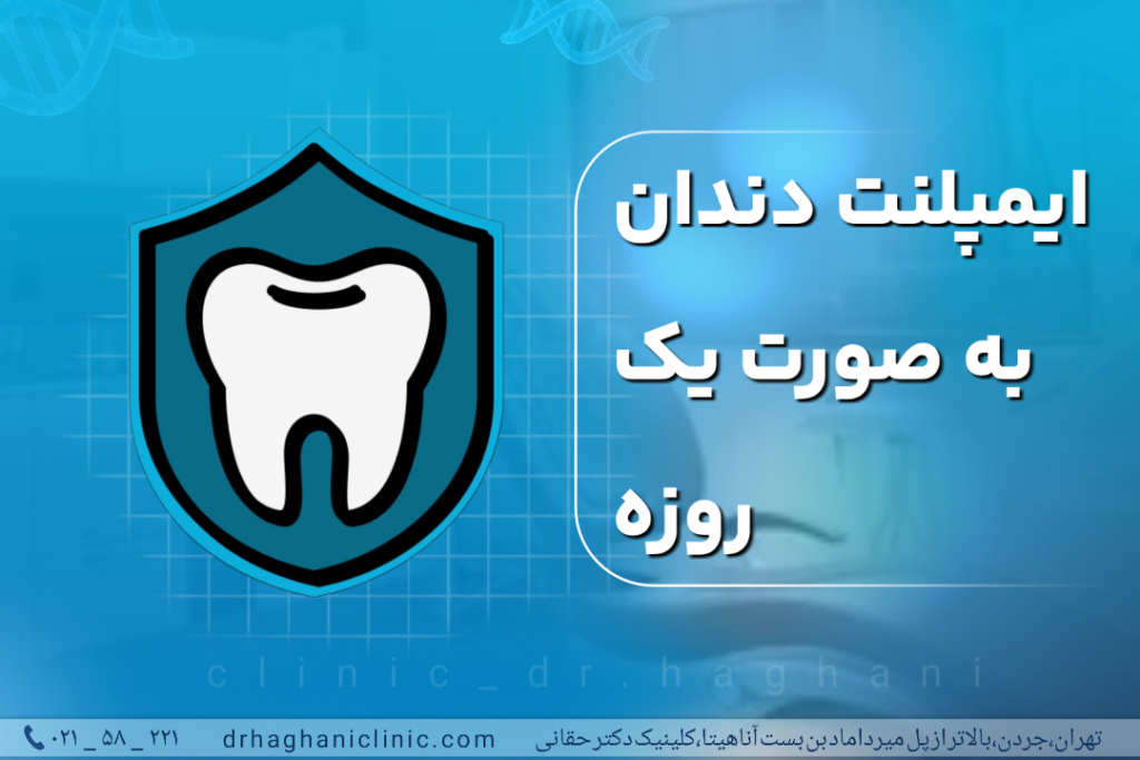 ایمپلنت دندان به صورت یک روزه