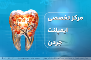 مرکز تخصصی ایمپلنت جردن