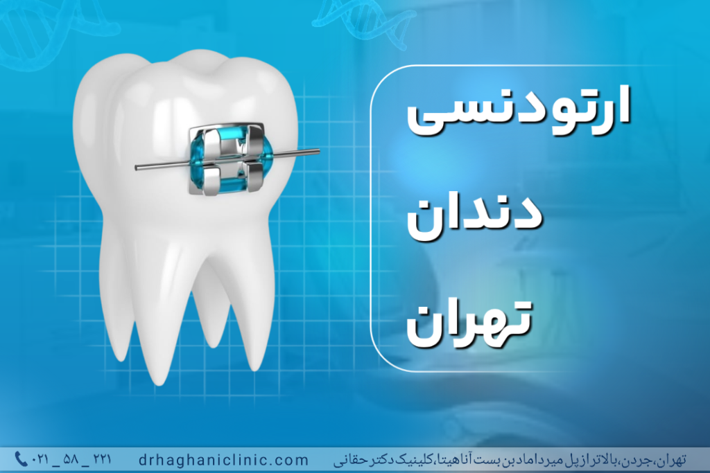 ارتودنسی دندان تهران