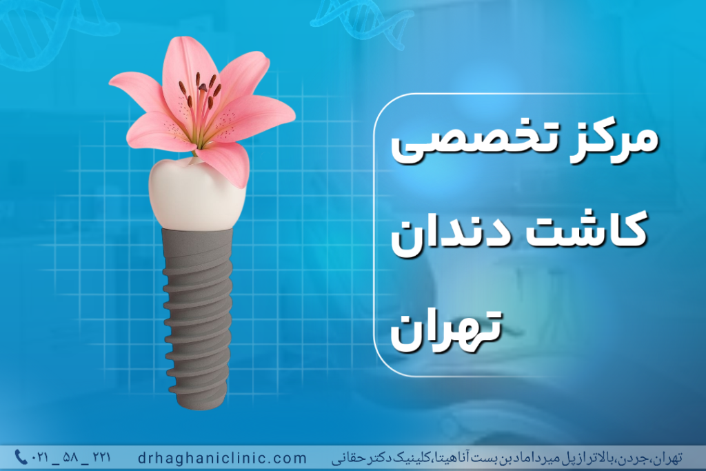 مرکز تخصصی کاشت دندان تهران