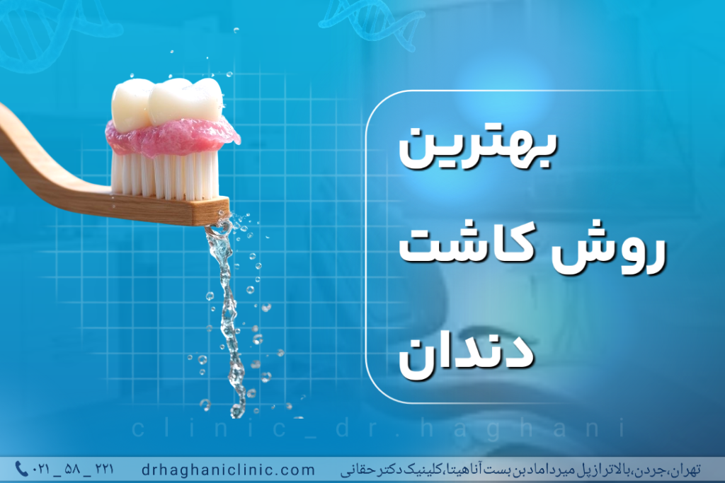 بهترین روش کاشت دندان