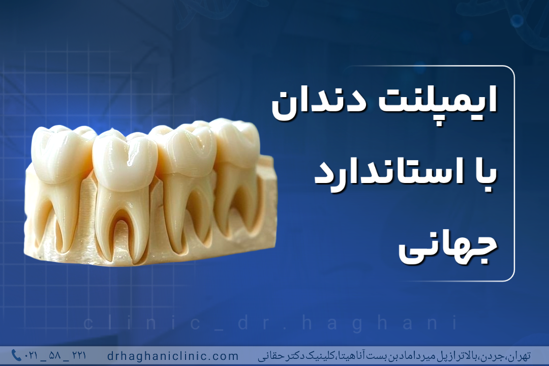 ایمپلنت دندان با استاندارد جهانی