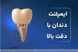 ایمپلنت دندان با دقت بالا