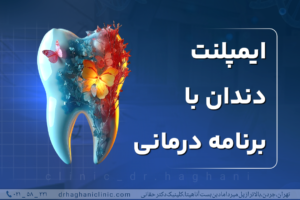 ایمپلنت دندان با برنامه درمانی