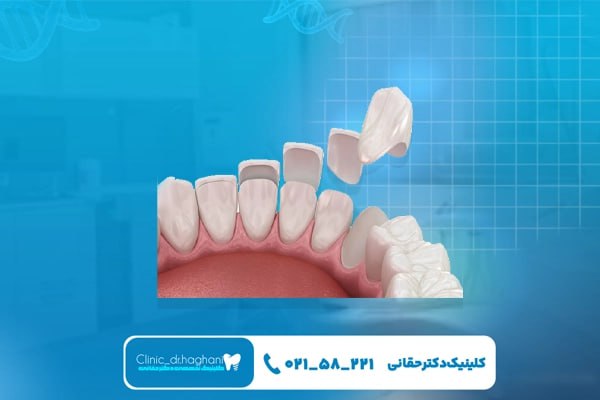 بهترین دندانپزشکی پیشرفته شمال تهران