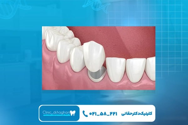 بهترین دندانپزشکی پیشرفته شمال تهران