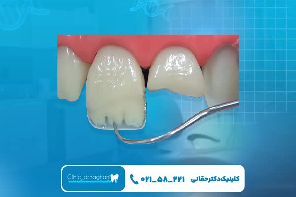 مزیت‌های دندانپزشکی دیجیتال